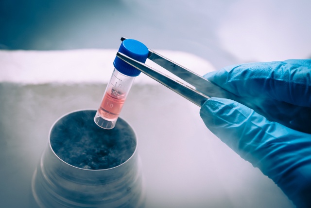 Paciente com sucessivas recidivas de linfoma não Hodgkin precisa de transplante autólogo de células-tronco com protocolo compatível com sua recusa a transfusões de sangue por convicção religiosa.